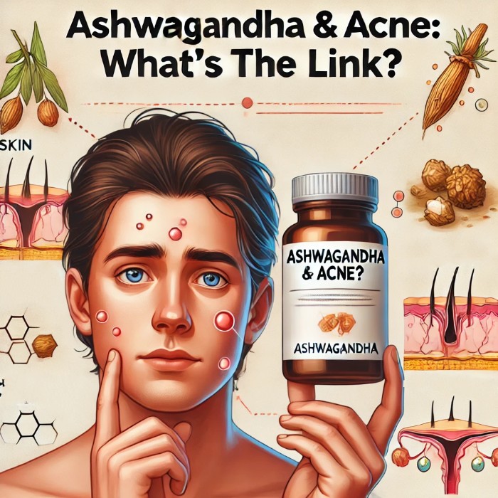 Can Ashwagandha cause acne